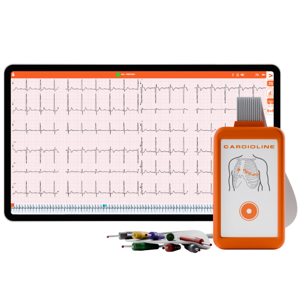 Cardioline TouchECG